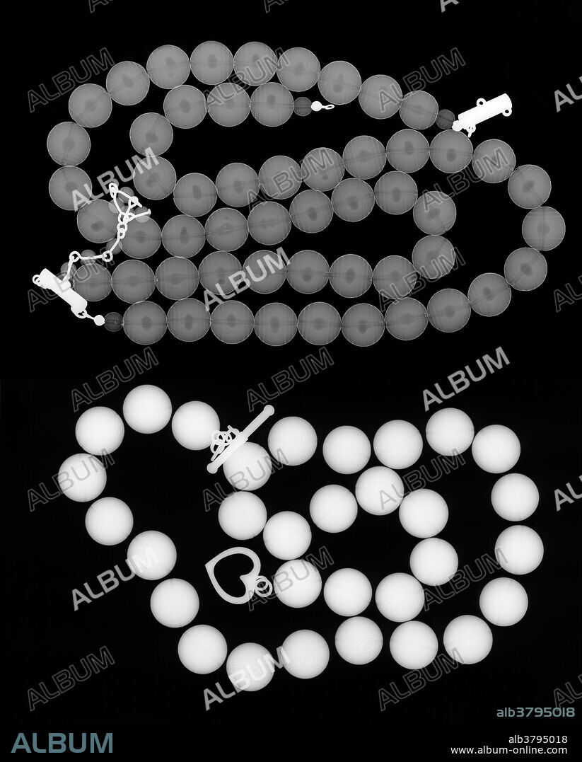 X-ray of two Pearl Strands. The fake pearl strand at the top is made from plastic which x-rays can easily pass through. The real pearls are much denser an are not as easily penetrated. Real Pearls are accretions of nacre (calcium carbonate) secreted by certain oysters and mussels. The presence of a foreign body (such as a parasite or a grain of sand) within the shell triggers the secretion of nacre by the creature's mantle. Thin layers are deposited on the irritant particle and, over several years, a pearl is formed.