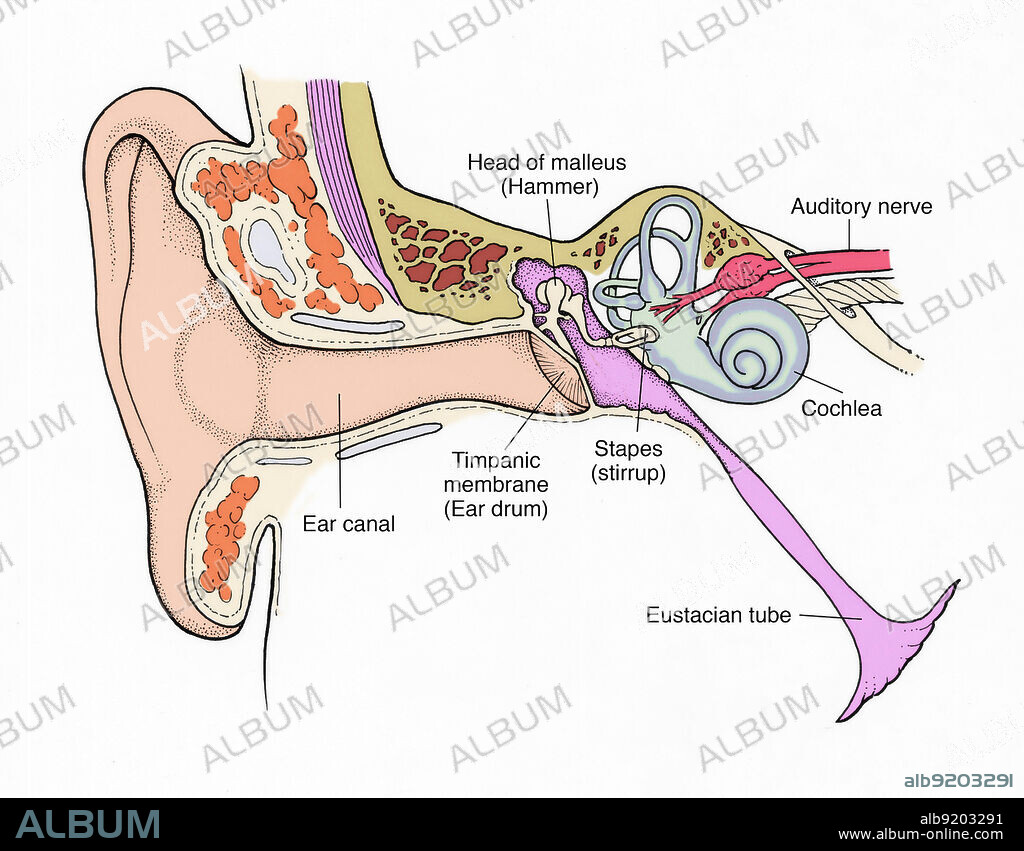 Anatomical illustration of the inner ear, showing ear canal, timpanic membrane (ear drum), stapes (stirrup), eustacian tube, cochlea, auditory nerve, and head of malleus (hammer).