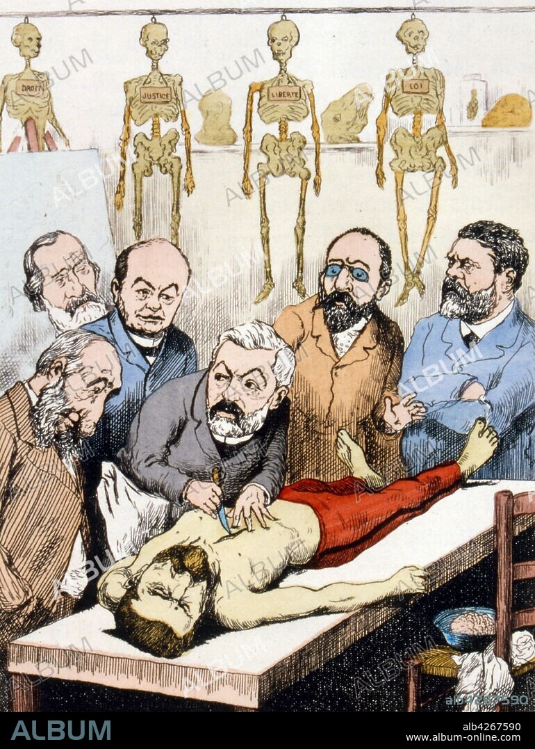 French satirical Illustration showing opponents of Boulanger performing an autopsy. 1889. Georges Boulanger (1837 – 1891), was a French general and politician. An enormously popular public figure during the Third Republic, he won a series of elections and was feared to be powerful enough to establish himself as dictator at the apogee of his popularity in January 1889.