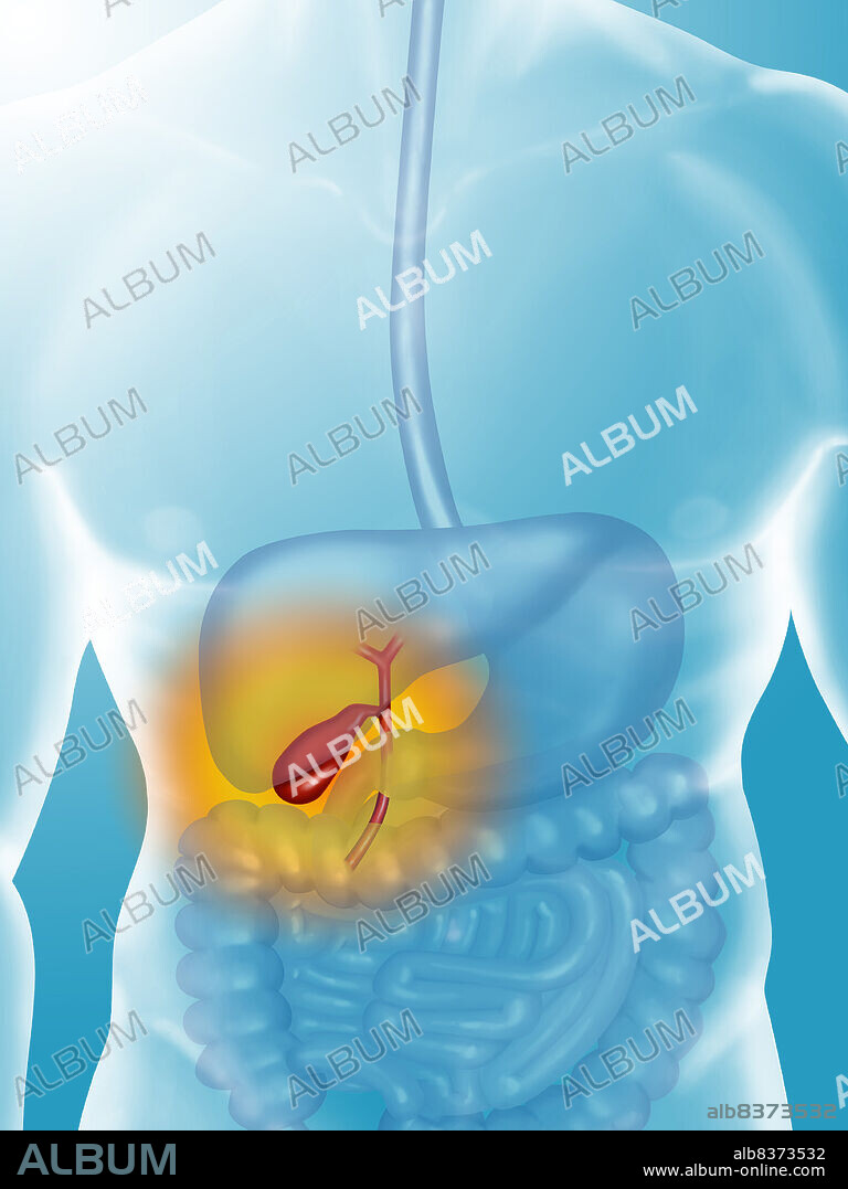 Illustration of pains at the level of the bladder and bile ducts.. Bile ducts are composed of cystic duct (exit of the gall bladder), hepatic ducts (carrying the bile outside the liver) that join to form the ductus choledochus, discharging the bile into the duodenum.. See. image 8811806 for a feminine silhouette.. See. images 8812906 for the intestines, 8813006 for the intestinum tenue, 8813106 for the large intestine, 8812806 for the liver and 8813406 for the gall bladder.