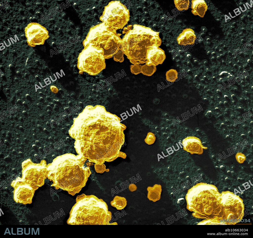Scanning electron micrograph (SEM) of Casein micelles. Casein micelles are minute protein globules that continually collide and ricochet in fresh milk. Their free path is about 3 micelle diameters. Under the effects of enzymes (chymosis) or acids the proteins coagulate. This image shows the beginning of coagulation, where the casein micelles begin to form clusters. The minute particles on the base are submicellart casein. (Image width: 0.61 micrometer, bar: 0.1 micrometer.).