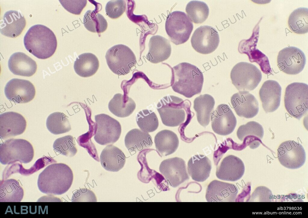 Light micrograph of a human blood smear showing Trypanosoma brucei rhodesiense, a parasitic protist species that causes African trypanosomiasis (or sleeping sickness) in humans via the tsetse fly. Trypanosome flagellates and red blood cells can be seen. Magnification: 500X at 35mm.