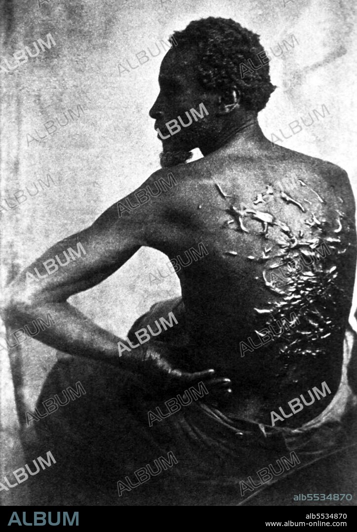 Gordon, or Whipped Peter, was a slave on a Louisiana plantation who made his escape from bondage in March of 1863 and went on to serve as a soldier in the United States Colored Troops. The photographs showing Gordon's flagellation scars were frequently used by abolitionists throughout the United States and internationally. In July of 1863 these images appeared in an article about Gordon published in Harper's Weekly, the most widely read journal during the Civil War. The pictures of Gordon's scourged back provided Northerners with visual evidence of brutal treatment of slaves and inspired many free blacks to enlist in the Union Army.