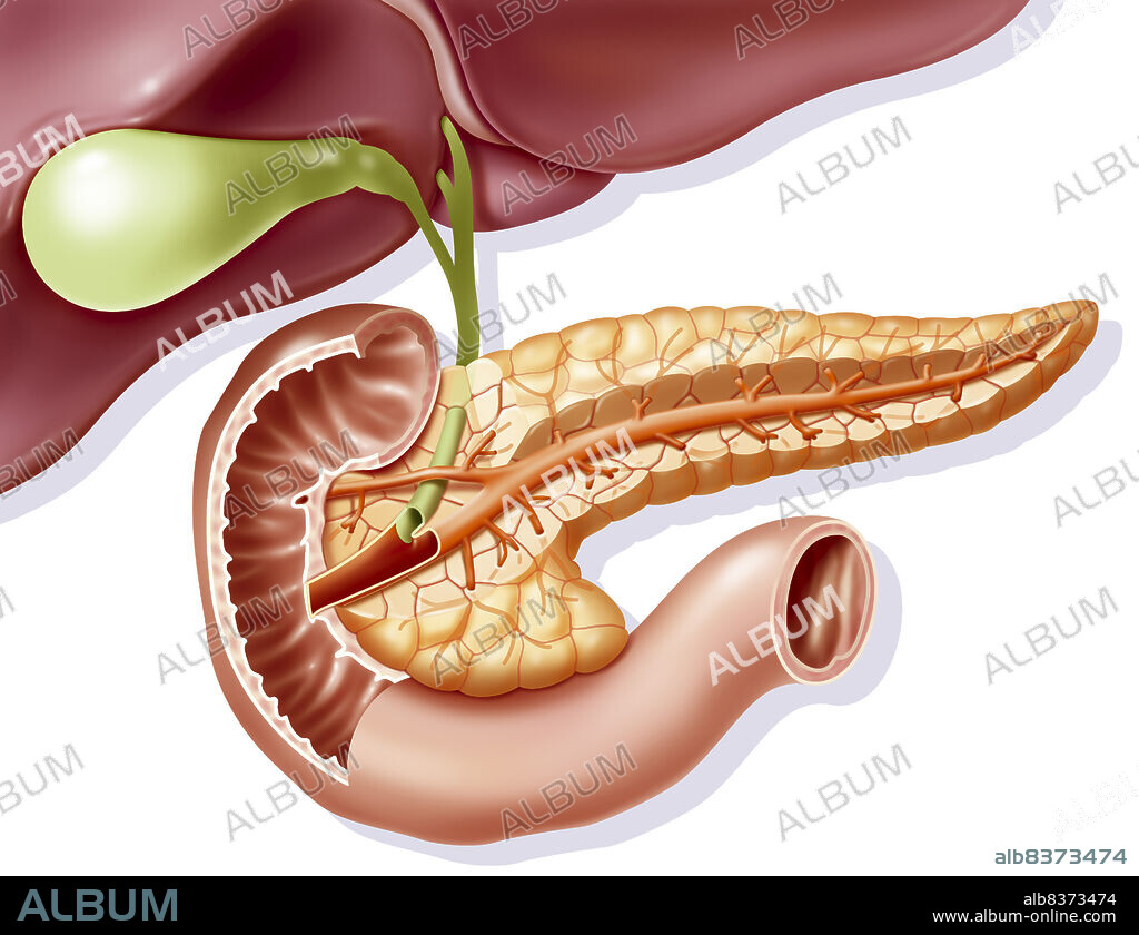Représentation de l'anatomie du pancréas en coupe en vue antérieure avec ses rapports avec la vésicule et le canal cholédoque (vert), le duodénum en coupe(beige foncé) et le foie (brun rouge).. Représentation en transparence en orange foncé des canaux pancréatiques.