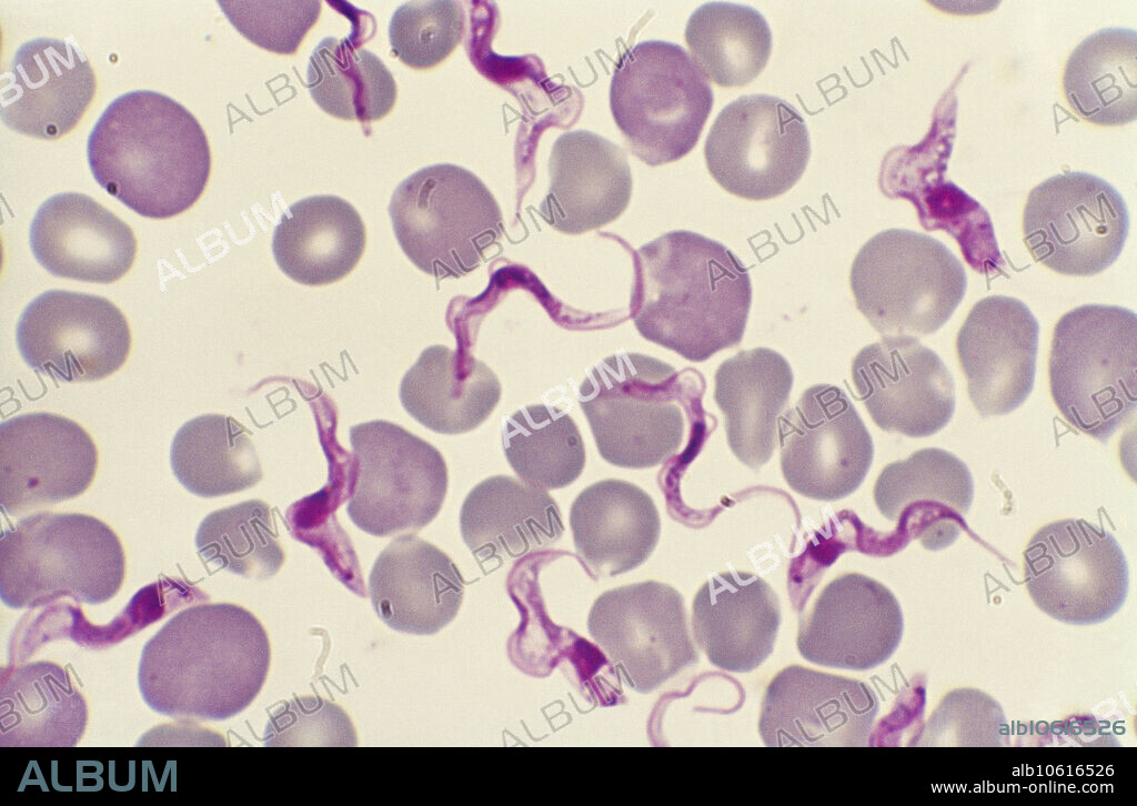 Light micrograph of a human blood smear showing Trypanosoma brucei rhodesiense, a parasitic protist species that causes African trypanosomiasis (or sleeping sickness) in humans via the tsetse fly. Trypanosome flagellates and red blood cells can be seen. Magnification: 500X at 35mm.