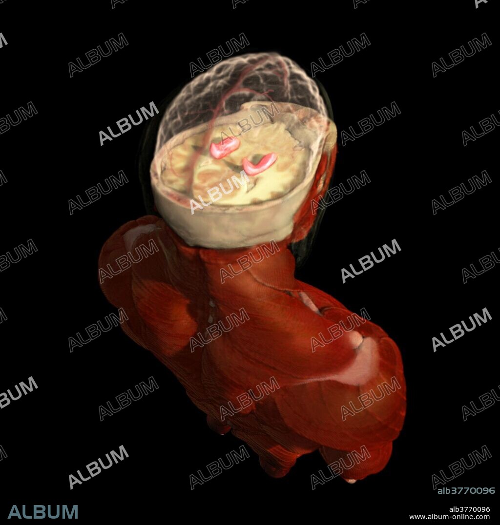 Hippocampus is shown highlighted in red.