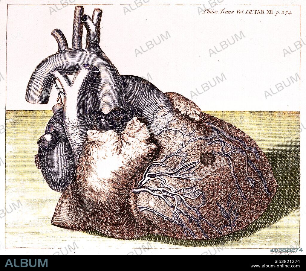 Engraving of damaged heart of King George II, 1761. An 18th-century journal page showing the heart of King George II of Great Britain (1683-1760), as examined following his death from an aortic aneurysm and rupture of the right ventricle. This artwork depicts the aneurysm and rupture. The examination was carried out by the king's physician Frank Nicholls (1699-1778). This page is from volume 52 (1761-2) of the journal "Philosophical Transactions", published by the Royal Society of London. It forms part of the account published by Nicholls, elected a Fellow of the Royal Society in 1728.