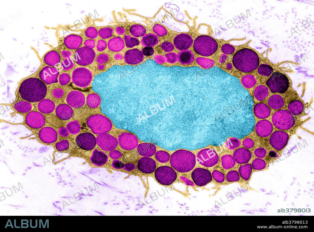Colour enhanced transmission electron micrograph (TEM) of a human mast cell in connective tissue. The large oval structure in centre is the nucleus (blue), containing the cell's genetic material. The cytoplasm contains numerous granules (pink) which are released in response to inflammation or allergy. The granules contain heparin, histamine & serotonin. Heparin is an anti-coagulant; histamine increases the permeability of blood vessel walls. Release of granule contents probably occurs where there is a tendency for blood clot formation, or as part of the body's general defence mechanism at sites of infection.