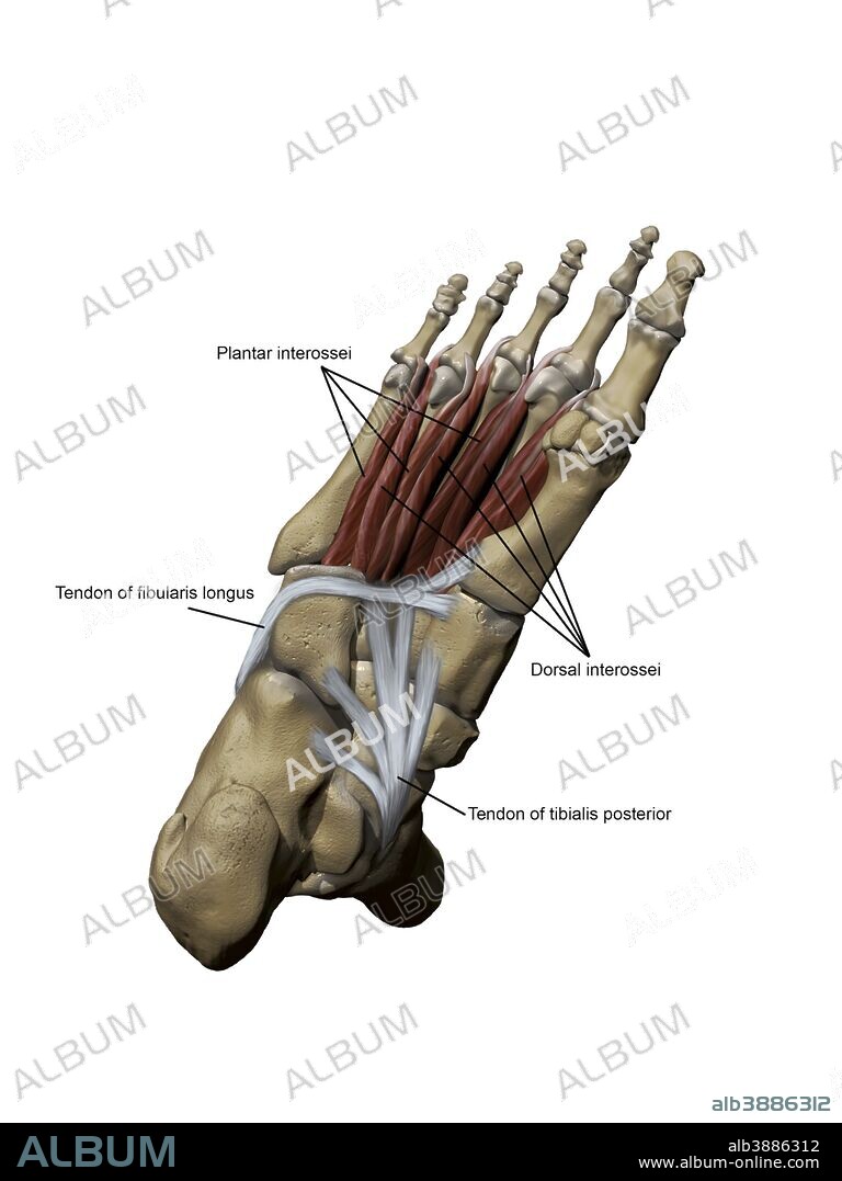 3D model of the foot depicting the plantar deep muscles and bone structures with annotations.