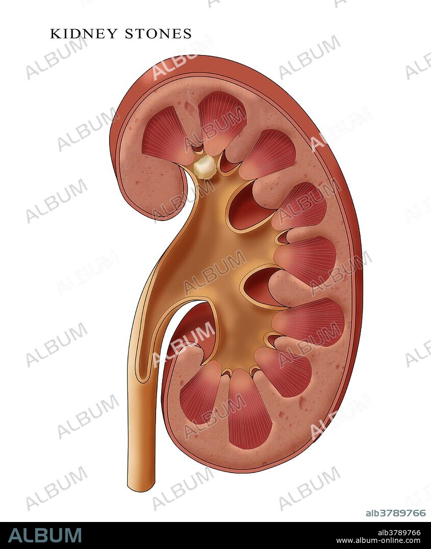 Calyceal Stone, Illustration