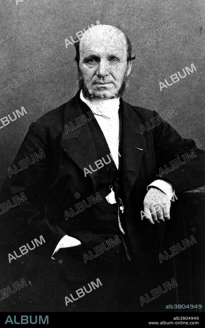 Guillaume-Benjamin-Amand Duchenne de Boulogne (September 17, 1806 - September 15, 1875) was a French neurologist who advanced the science of electrophysiology. The era of modern neurology progressed from Duchenne's understanding of the conductivity of neural pathways, his revelations of the effect of lesions on these structures and his diagnostic innovations including deep tissue biopsy, nerve conduction tests (NCS), and clinical photography. His greatest contributions were made in the myopathies that came to immortalize his name, Duchenne Muscular Dystrophy, Duchenne-Aran spinal muscular atrophy, Duchenne-Erb paralysis, Duchenne's disease (Tabes dorsalis), and Duchenne's paralysis (Progressive bulbar palsy). He was the first clinician to practice muscle biopsy, the harvesting of in vivo tissue samples with an invention called Duchenne's trocar. In 1855 he formalized the diagnostic principles of electrophysiology and introduced electrotherapy in a textbook titled, De l'electrisation localisÃ©e et de son application Ã  la physiologie, Ã  la pathologie et Ã  la thÃ©rapeutique. A companion atlas to this work titled, Album de photographies pathologiques, was the first neurology text illustrated by photographs. He died of hemorrhagic bleeding in 1875, after several years of illness. He was 68 years old.