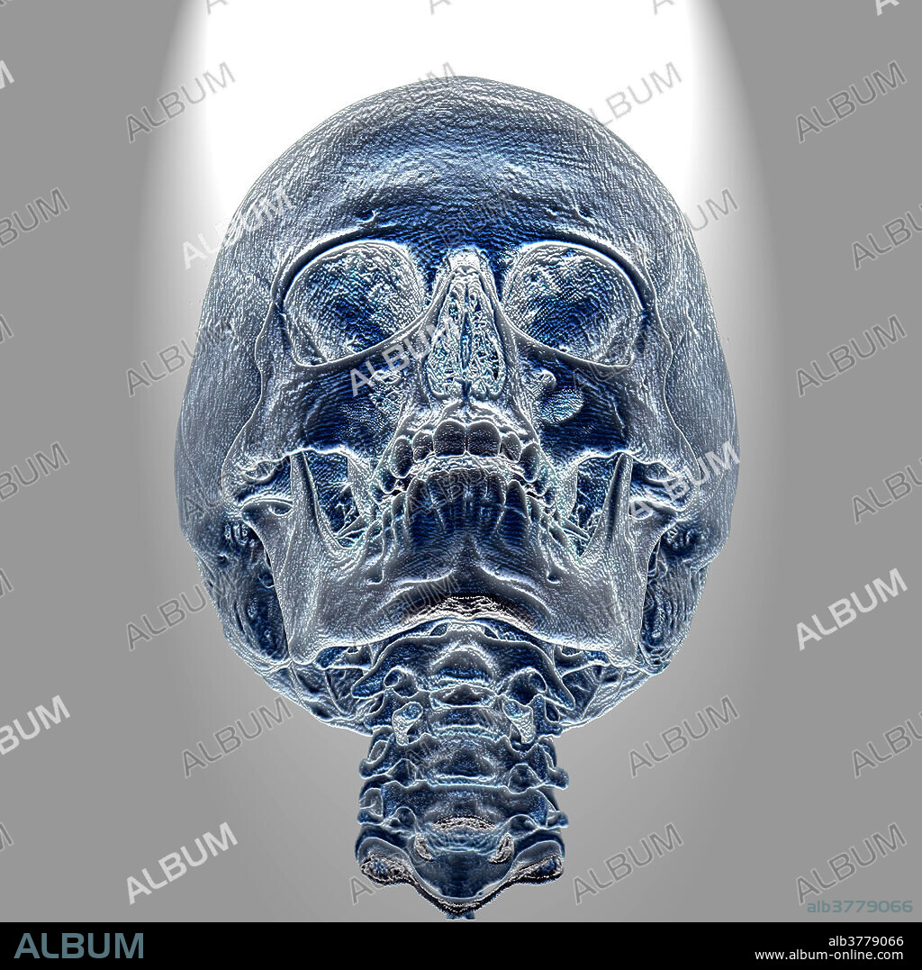 Normal Skull, 3D CT scan - Album alb3779066