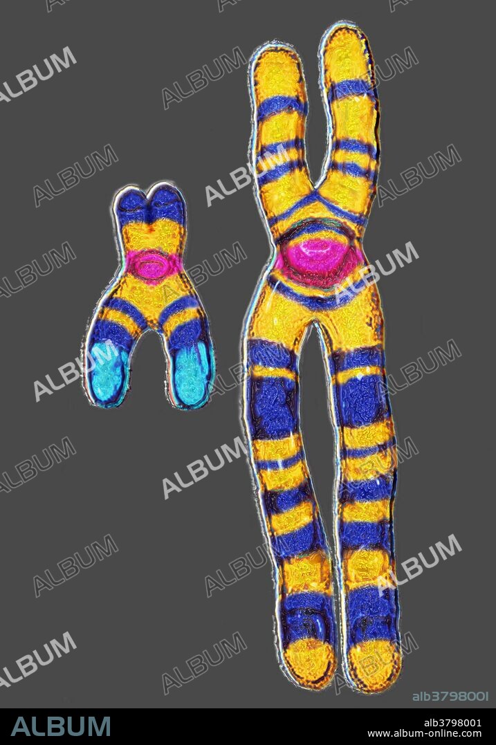 Male XY Chromosome under a microscope