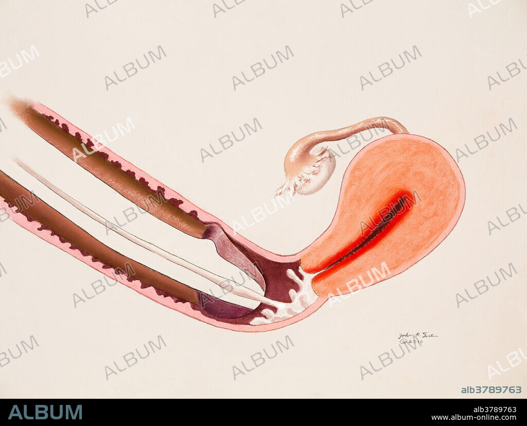 Anatomical illustration showing the penis ejaculating into the vagina near the cervix during sexual intercourse.