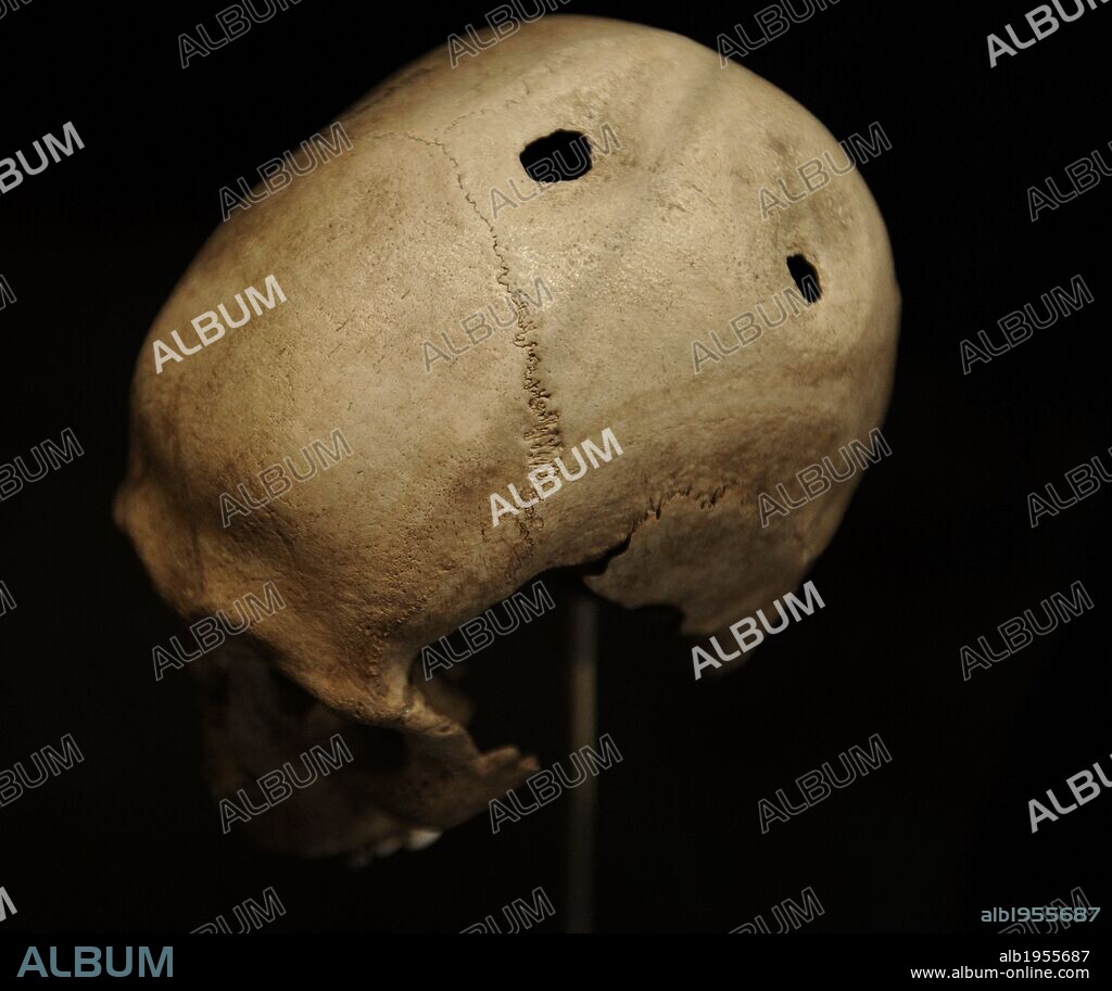 ARTE. PREHISTORIA. EUROPA. Un cráneo de Døjringe con dos trepanaciones. 21-35 años de edad. Isla de Selandia. Fechado hacia el 3500-3400 a. C. Museo Nacional. Copenhague. Dinamarca. Europa.