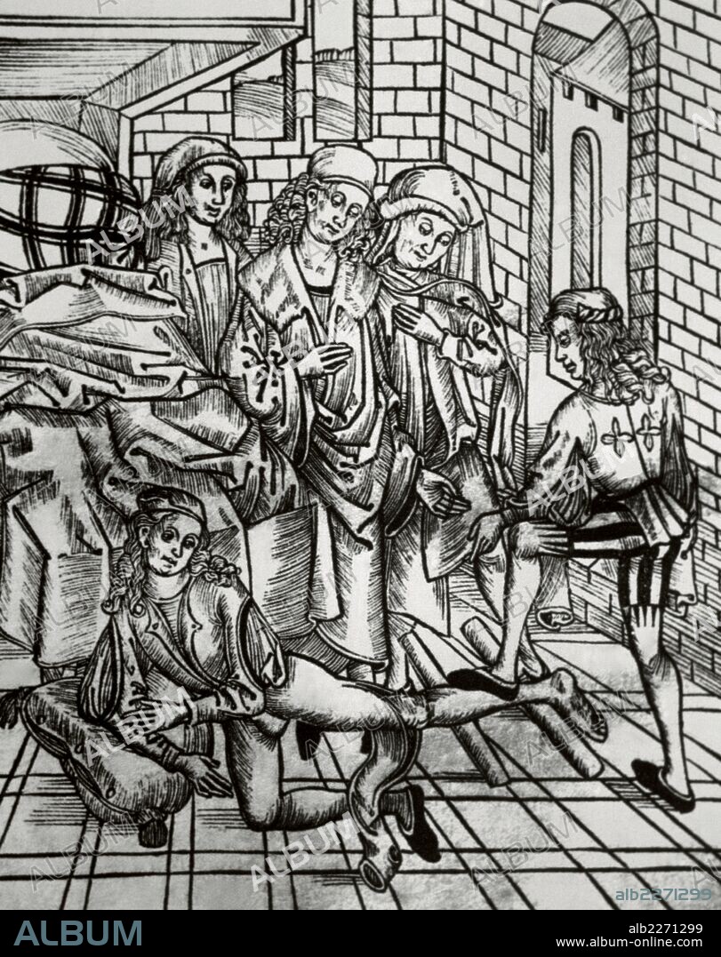 HIERONYMUS BRUNSCHWIG. HISTORIA DE LA MEDICINA. EDAD MODERNA. "COLOCACION Y TRATAMIENTO DE UN HUESO FRACTURADO DE LA PIERNA". Xilografía de la obra "DIES IST DAS BUCH DER CHIRURGIA" (siglo XV) .