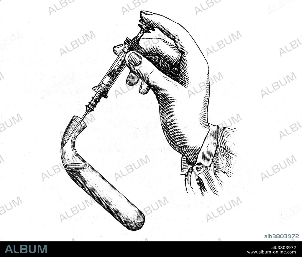 Pravaz syringe, 1833. Illustration showing a syringe returning the vaccine for animals to the test tube as a way to avoid air bubbles after a first extraction. Charles Gabriel Pravaz (1791-1853) was a French orthopedic surgeon and inventor of the hypodermic syringe.