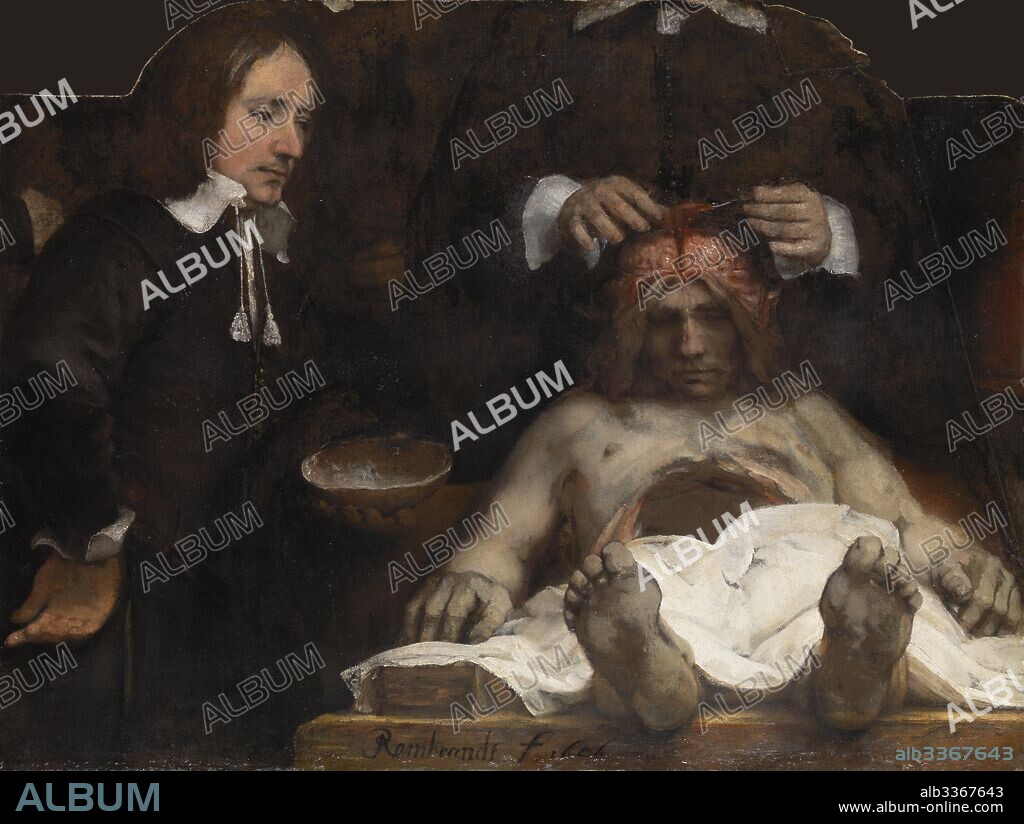 REMBRANDT VAN RHIJN. The Anatomy Lesson of Dr. Jan Deijman.