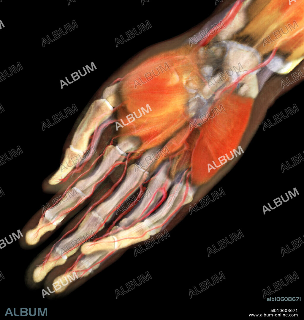 3D visualization based on scanned human data of the ventral side of a human right hand. On the palmar side, the thenar and hypothenar muscles are visible; lying beneath them are the metacarpal bones. The phalanges are revealed with the palmar digital arteries running also aside them.