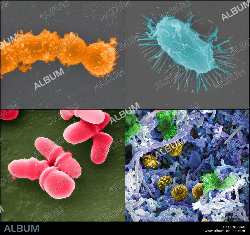 The Human Microbiome Project, which was launched by the NIH in 2007, provided the first insight into the microbial life of healthy humans and explores possible relationships between particular human diseases and the microbiome. (Clockwise from top left): Streptococcus (Credit: Tom Schmidt) Mixed species microbial biofilm, from the human body (Credit: A. Earl, Broad Institute/MIT) Bacillus (Credit : Tom Schmidt) Malassezia lopophilis (Credit: JH Carr, CDC).