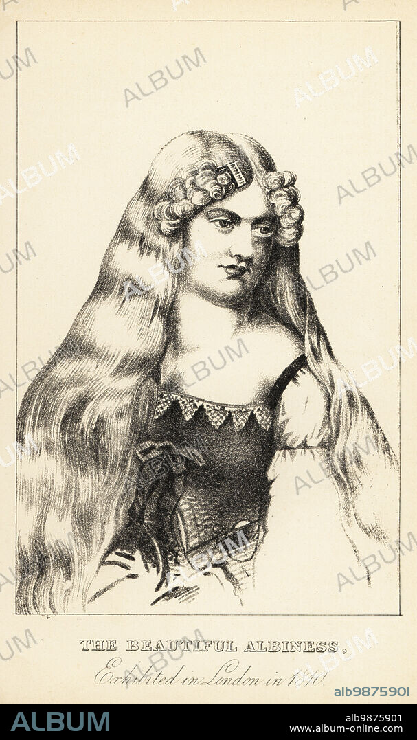 Miss Harvey, albino woman with silk hair perfectly white and pink eyes. She was exhibited at Brookes Original Menagerie in 1800, and at Whigleys Royal Promenade Rooms, Spring Gardens (Charing Cross) in 1810. The Beautiful Albiness, exhibited in London. Lithograph after a stipple engraving by Robert Cooper from Henry Wilson and James Caulfields Book of Wonderful Characters, Memoirs and Anecdotes, of Remarkable and Eccentric Persons in all ages and countries, John Camden Hotten, Piccadilly, London, 1869.