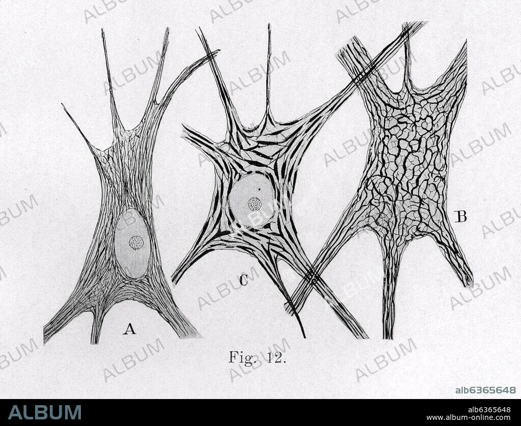 SANTIAGO RAMóN Y CAJAL. B Y C CAMBIOS EN LAS NEURONAS FUNICULARES DE UN CONEJO DE 15 DIAS CONSECUENCIA DE ESTAR 6 HORAS A 10 ºc - PEDIR DERECHOS.