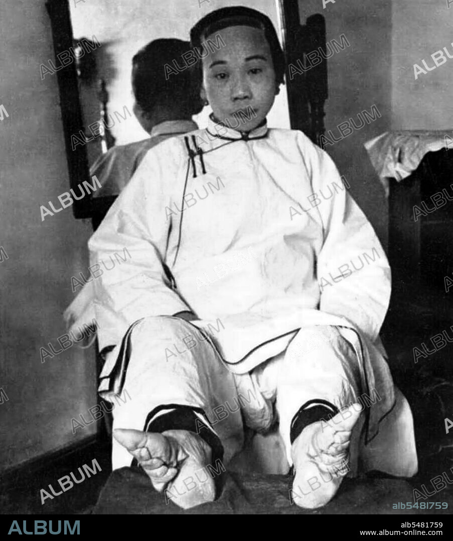 Foot binding (pinyin: chanzu, literally 'bound feet') was a custom practiced on young girls and women for approximately one thousand years in China, beginning in the 10th century and ending in the first half of 20th century. There is little evidence for the custom prior to the court of the Southern Tang dynasty in Nanjing, which celebrated the fame of its dancing girls, renowned for their tiny feet and beautiful bow shoes. What is clear is that foot binding was first practised among the elite and only in the wealthiest parts of China, which suggests that binding the feet of well-born girls represented their freedom from manual labor and, at the same time, the ability of their husbands to afford wives who did not need to work, who existed solely to serve their men and direct household servants while performing no labor themselves. Bound feet were considered intensely erotic in traditional Chinese culture. Qing Dynasty sex manuals listed 48 different ways of playing with women's bound feet. Some men preferred never to see a woman's bound feet, so they were always concealed within tiny 'lotus shoes' and wrappings. Feng Xun is recorded as stating, 'If you remove the shoes and bindings, the aesthetic feeling will be destroyed forever' - an indication that men understood that the symbolic erotic fantasy of bound feet did not correspond to its unpleasant physical reality, which was therefore to be kept hidden. For men, the primary erotic effect was a function of the lotus gait, the tiny steps and swaying walk of a woman whose feet had been bound.