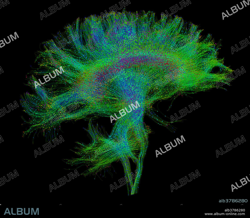 Amazon.com: Diffusion Tensor Imaging: A Practical Handbook