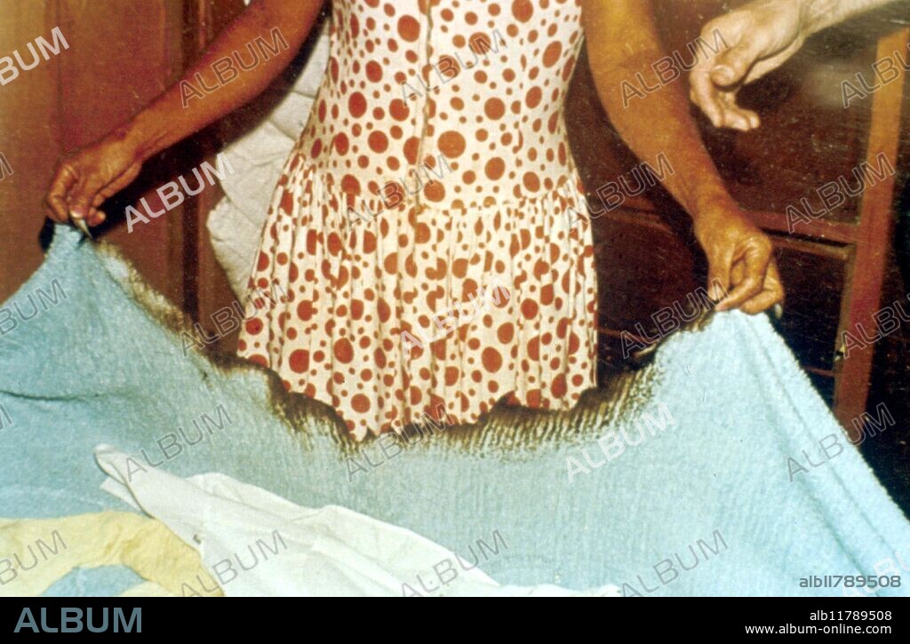 Ipiranga poltergeist case, Sao Paulo, Brazil, 1973: Burned blanket in Suzano poltergeist case, Brazil, 1970.