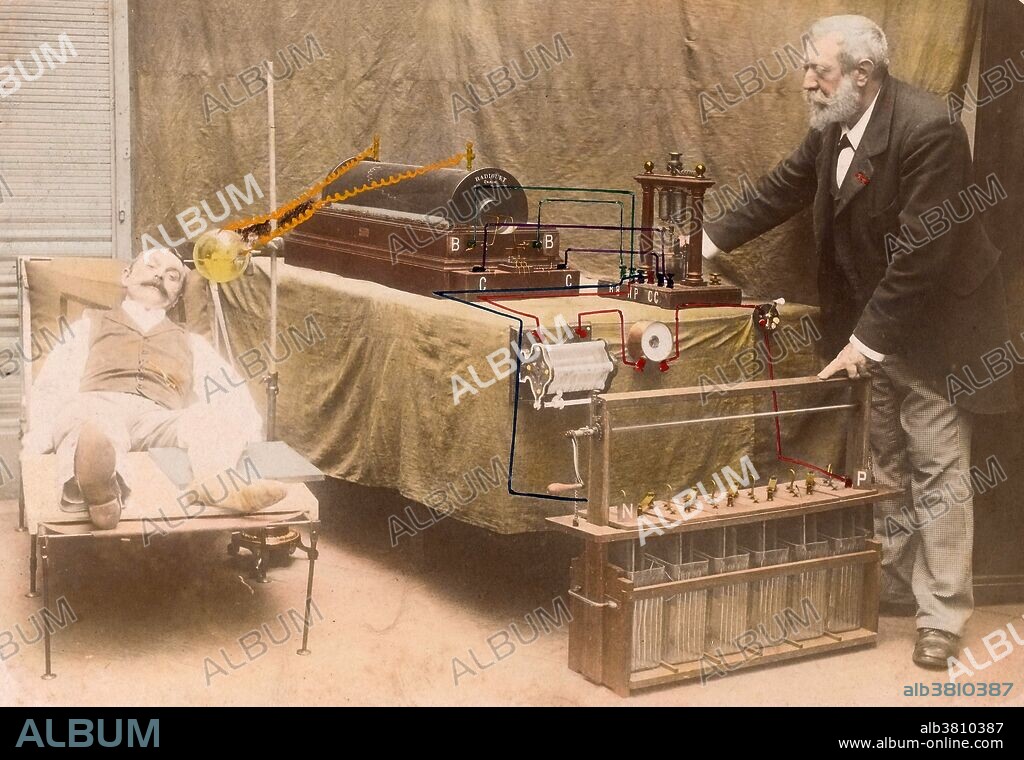 Arthur Radiguet making a radiograph (x-ray) of a recumbent man, 1898. German physicist Wilhelm Rontgen is usually credited as the discoverer of x-rays in 1895, because he was the first to systematically study them, though he is not the first to have observed their effects. He is also the one who gave them the name "x-rays" (signifying an unknown quantity) though many others referred to these as "Rontgen rays" (and the associated x-ray radiograms as, "Rontgenograms" for several decades after their discovery.