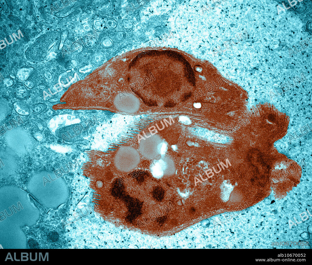 Trypanosoma Cruzi, TEM