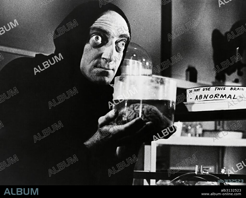 MARTY FELDMAN en EL JOVENCITO FRANKENSTEIN, 1974 (YOUNG FRANKENSTEIN), dirigida por MEL BROOKS. Copyright 20TH CENTURY FOX.