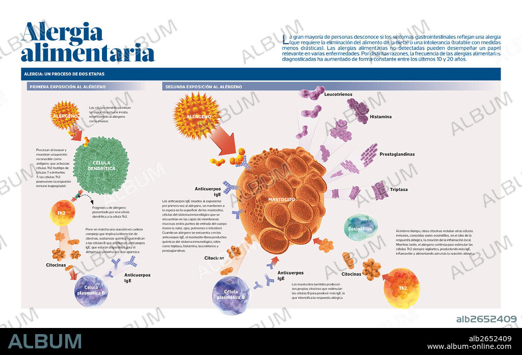 Alergia alimentaria. Infografía sobre las alergias alimentarias.