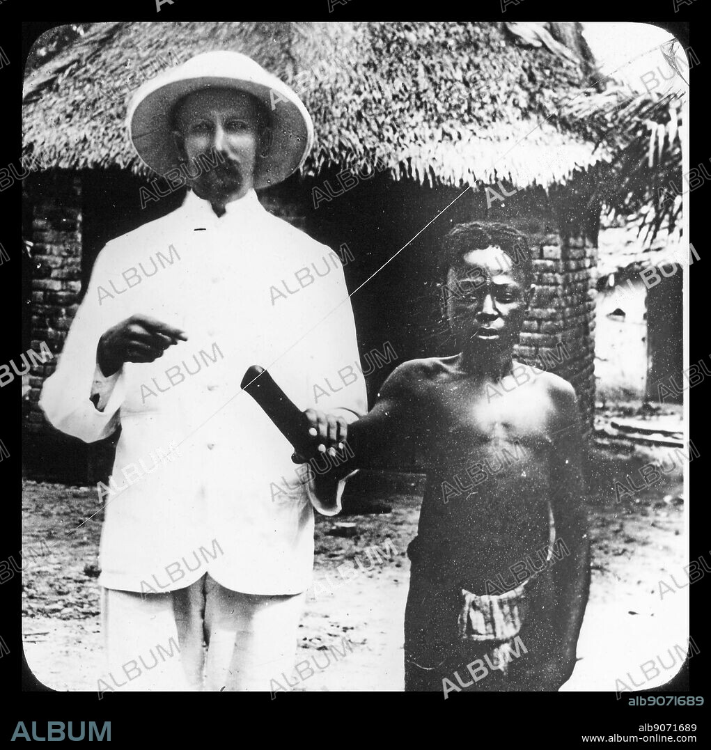 King Leopold II of Belgium's administration of the Congo Free State was characterised by atrocities, including torture and murder, resulting from notorious systematic brutality. The hands of men, women, and children were amputated when the quota of rubber was not met and millions of the Congolese people died.