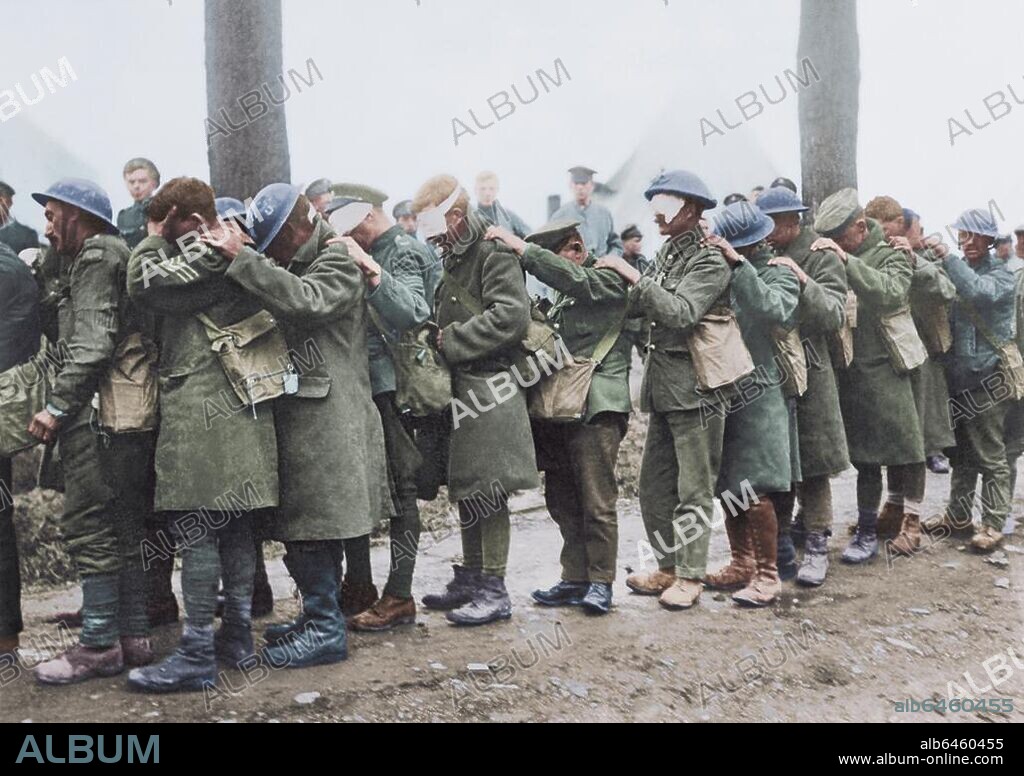 Geschichte / 1.Weltkrieg / Westfront.-Von Tränengas geblendete britische Soldaten auf einem Verbandsplatz bei Estalres (?).-Foto, 10. April 1918; digitale Kolorierung.