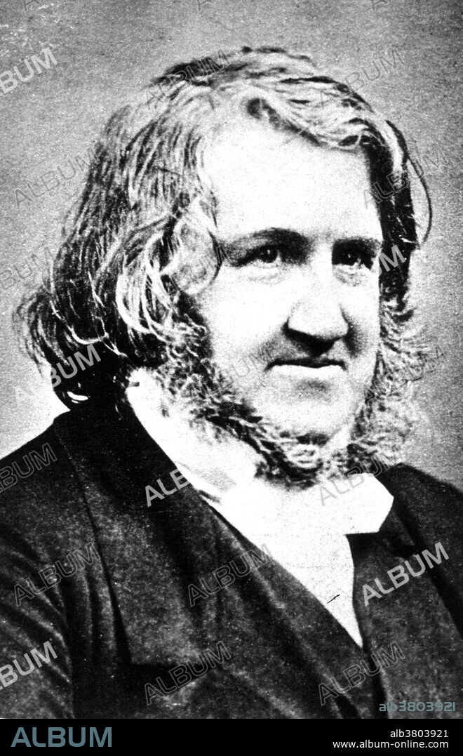 James Young Simpson (1811-1870) was a Scottish physician and anesthetic pioneer. Simpson entered the University of Edinburgh when he was 14 years old, completed final examination at the age of 18, but had to wait two years before he got his license to practice medicine. He improved the design of obstetric forceps and fought against the contagion of puerperal sepsis. In 1847, Simpson discovered the properties of chloroform during an experiment with friends in which he learnt that it could be used to put one to sleep. His most noted contribution was the introduction of anesthesia to childbirth. He was a very early advocate of the use of midwives in the hospital environment. He died at his home in 1870 at the age of 58.
