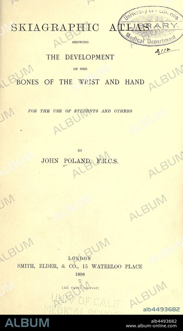 Skiagraphic atlas showing the development of the bones of the wrist and hand : for the use of students and others : Poland, John, 1855-1937.