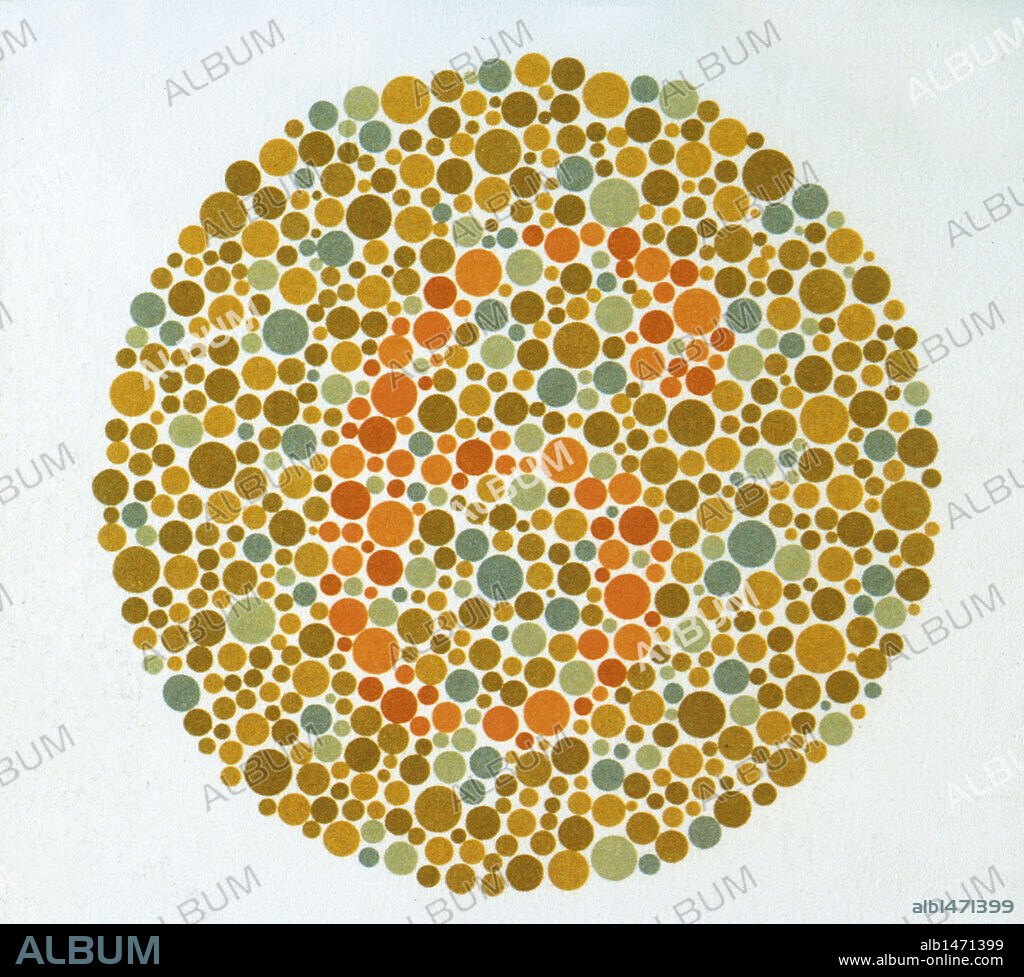LAMINAS ISHIHARA. Método para diagnosticar el daltonismo. LAMINA Nº 3: En los casos de visión normal se lee como 6. En la mayoría de casos de deficiencias visuales cromáticas no pueden leerlo o lo leen incorrectamente.