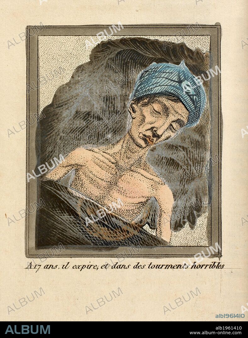 At the age of 17, he expires, and in horrible torment!  . Le Livre Sans Titre (the book without title.). Paris 1830. A book warning of the deadly perils of self abuse, or masturbation. The illustraions show the decline of a healthy and handsome young man under the influence of the vice. Source: 12316.eee.11. Language: French.