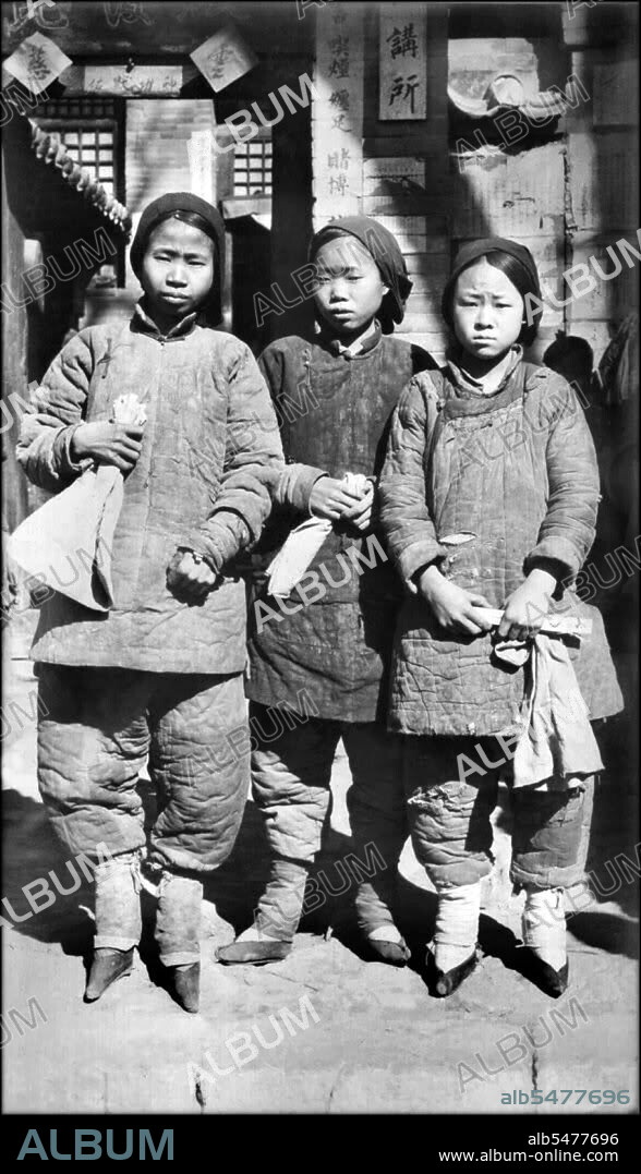 Foot binding (pinyin: chanzu, literally 'bound feet') was a custom practiced on young girls and women for approximately one thousand years in China, beginning in the 10th century and ending in the first half of 20th century. There is little evidence for the custom prior to the court of the Southern Tang dynasty in Nanjing, which celebrated the fame of its dancing girls, renowned for their tiny feet and beautiful bow shoes. What is clear is that foot binding was first practised among the elite and only in the wealthiest parts of China, which suggests that binding the feet of well-born girls represented their freedom from manual labor and, at the same time, the ability of their husbands to afford wives who did not need to work, who existed solely to serve their men and direct household servants while performing no labor themselves. Bound feet were considered intensely erotic in traditional Chinese culture. Qing Dynasty sex manuals listed 48 different ways of playing with women's bound feet. Some men preferred never to see a woman's bound feet, so they were always concealed within tiny 'lotus shoes' and wrappings. Feng Xun is recorded as stating, 'If you remove the shoes and bindings, the aesthetic feeling will be destroyed forever' - an indication that men understood that the symbolic erotic fantasy of bound feet did not correspond to its unpleasant physical reality, which was therefore to be kept hidden. For men, the primary erotic effect was a function of the lotus gait, the tiny steps and swaying walk of a woman whose feet had been bound.