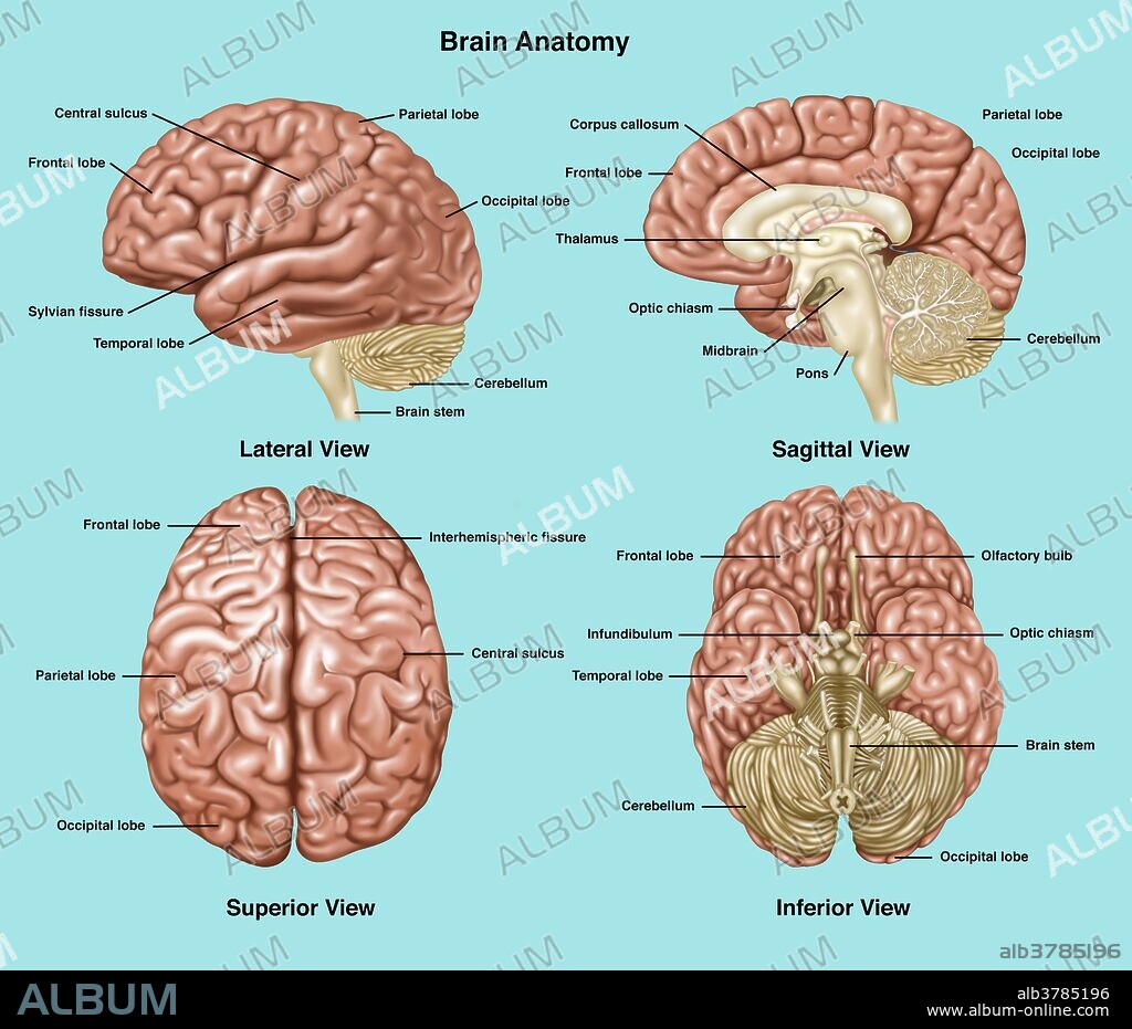 Illustration showing anatomy of a normal brain in lateral, sagittal, superior, and inferior view. Notated are frontal lobe, central sulcus, parietal lobe, sylvian fissure, temporal lobe, occipital lobe, cerebellum, brain stem, corpus callosum, thalamus, optic chiasma, midbrain, pons, interhemispheric fissure, olfactory bulb, and infundibulum.