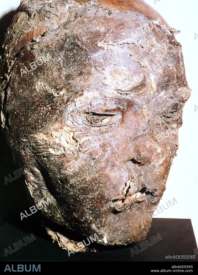 Mummified head of a Scythian chief from barrow 2, Pazyryk, Altai. The skull has been damaged by a battle axe blow, 5th century BC.