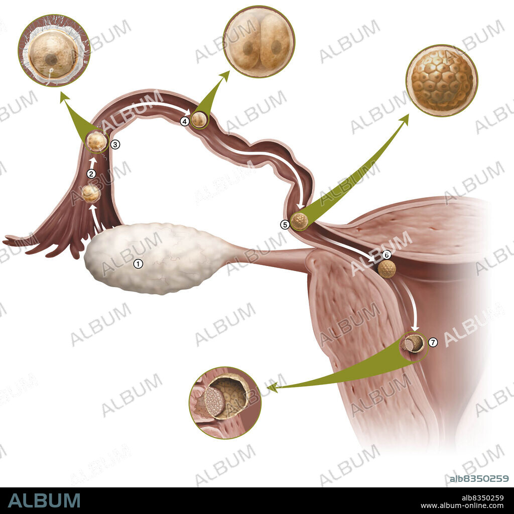 Nidation is the implantation of a fertilized egg in the endometrium, six or seven days after fertilization. The cells of its outer layer (trophoblast) multiply and erode the endometrium, which enables the blastocyst to anchor itself there. The implantation phase lasts approximately one week.