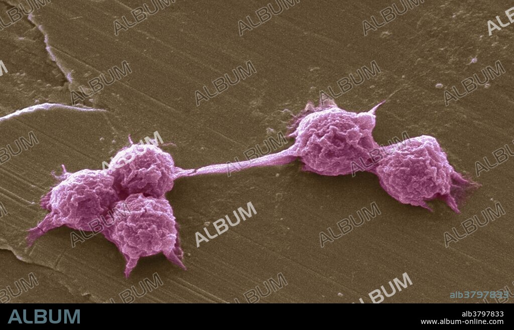 FLA, Vermamoeba vermiformis Cysts, under a microscope (SEM)