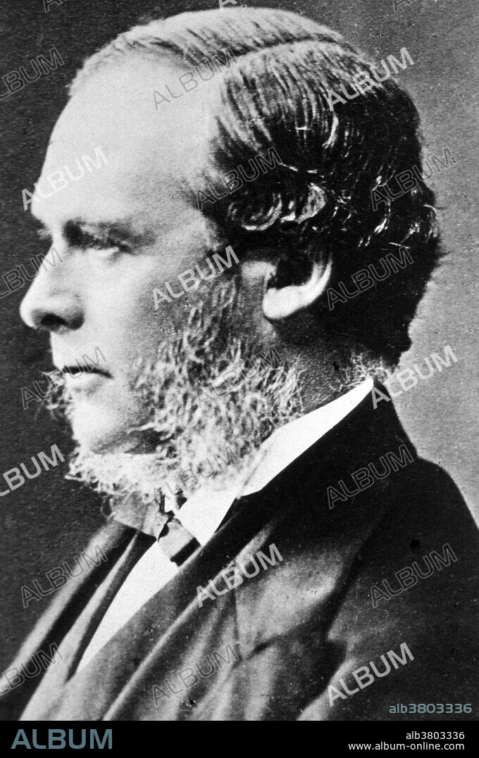 Joseph Lister (April 5,1827 - February 10, 1912) was an English surgeon and a pioneer of antiseptic surgery. Until Lister's studies of surgery most people believed that chemical damage from exposures to bad air (miasma) was responsible for infections in wounds. He found that carbolic acid solution swabbed on wounds remarkably reduced the incidence of gangrene. Lister tested the results of spraying instruments, the surgical incisions, and dressings with a solution of it. He instructed surgeons under his responsibility to wear clean gloves and wash their hands before and after operations with 5% carbolic acid solutions. Instruments were also washed in the same solution and assistants sprayed the solution in the operating theater. As the germ theory of disease became more widely accepted, it was realized that infection could be better avoided by preventing bacteria from getting into wounds in the first place. Lister died in 1912 at the age of 84.