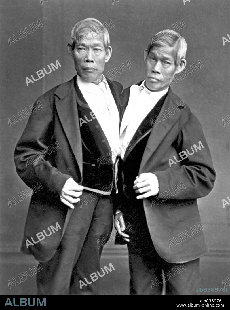 Chang and Eng Bunker (May 11, 1811 January 17, 1874) were Thai-American conjoined twin brothers whose condition and birthplace became the basis for the term 'Siamese twins'.<br/><br/>. The Bunker brothers were born on May 11, 1811, in the province of Samutsongkram, near Bangkok, in the Kingdom of Siam (today's Thailand). Their fisherman father was a Chinese Thai, while their mother was a Chinese Malaysian. Because of their Chinese heritage, they were known locally as the 'Chinese Twins'. The brothers were joined at the sternum by a small piece of cartilage, and though their livers were fused, they were independently complete.<br/><br/>. In 1829, Robert Hunter, a Scottish merchant who lived in Bangkok, saw the twins swimming and realized their potential. He paid their parents to permit him to exhibit their sons as a curiosity on a world tour. When their contract with Hunter was over, Chang and Eng went into business for themselves. In 1839, while visiting Wilkesboro, North Carolina, the brothers were attracted to the area and purchased a 110-acre (0.45 km2) farm in nearby Traphill.<br/><br/>. Determined to live as normal a life they could, Chang and Eng settled on their small plantation and bought slaves to do the work they could not do themselves. Using their adopted name 'Bunker', they married local women on April 13, 1843. Chang wed Adelaide Yates, while Eng married her sister, Sarah Anne. Chang and Adelaide would become the parents of eleven children. Eng and Sarah had ten. The twins also became naturalized American citizens.<br/><br/>. On January 17, 1874, Chang died while the brothers were asleep. Eng awoke to find his brother dead and cried, 'Then I am going'. A doctor was summoned to perform an emergency separation, but he was too late. Eng died approximately three hours later.