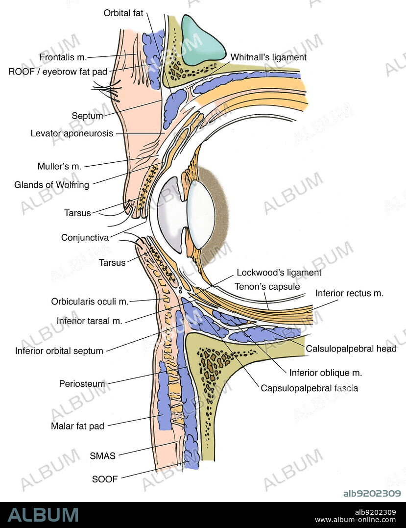 Anatomical illustration of eye, showing, orbital fat, Whitnall's ligament, Tenon's capsule, superior rectus m., levator m., inferior rectus m., Tenon's capsule, calsulopalpebral head, inferior oblique m., capsulopalpebral fascia, SOOF, SMAS, malar fat pad, periosteum, inferior orbital septum, inferior tarsal m., Lockwood's ligament, orbicularis oculi m., tarsus, conjunctiva, glands of Wolfring, Muller's m., levator aponeurosis, septum, orbicularis m., ROOF/eyebrow fat pad, and frontalis m.