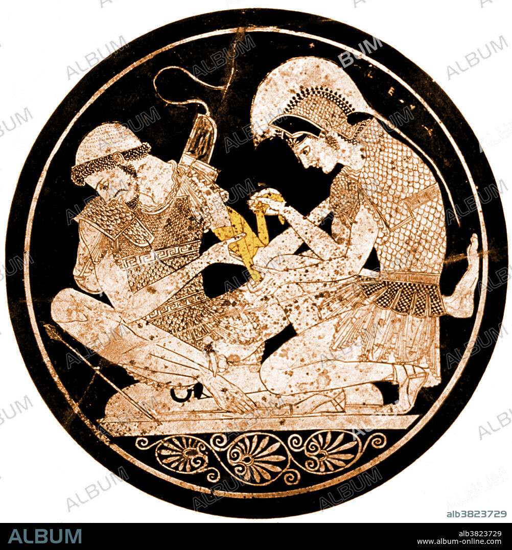 Achilles tending Patroclus' wounds from about 490-500 B.C. The painter is Euphronios, and the work is regarded as his masterpiece. In Greek mythology, Achilles was a Greek hero of the Trojan War, the central character and the greatest warrior of Homer's Iliad. Legends state that Achilles was invulnerable in all of his body except for his heel. He died because of a small wound on his heel, thus the term Achilles' heel has come to mean a person's principal weakness. Patroclus was the son of Menoetius, grandson of Actor, King of Opus, and was Achilles' beloved comrade and brother-in-arms. The exact nature of Achilles' relationship with Patroclus has been a subject of dispute in both the classical period and modern times.