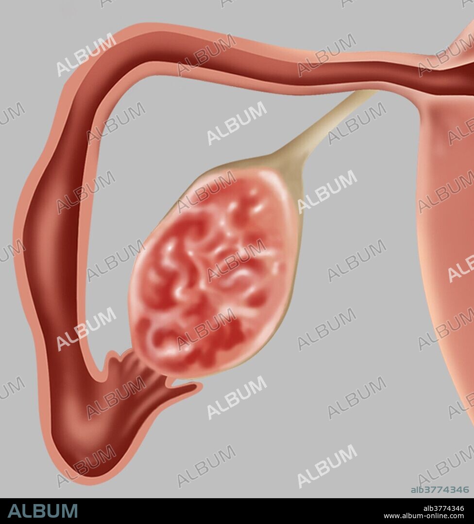 Illustration depicting a fallopian tube (oviduct) and ovary in cross section.