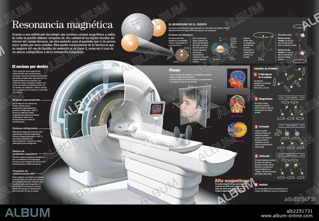 ? Magnetic Resonance Imaging. Infographic of the operation of a scanner for the magnetic resonance and the images of the body tissues.